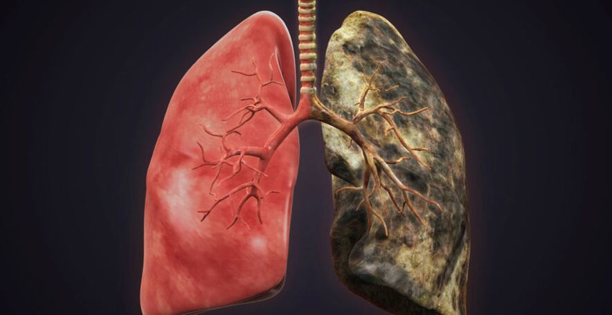 pulmón do fumador e deixar de fumar