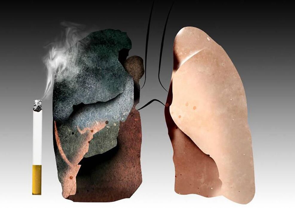 pulmóns dun fumador